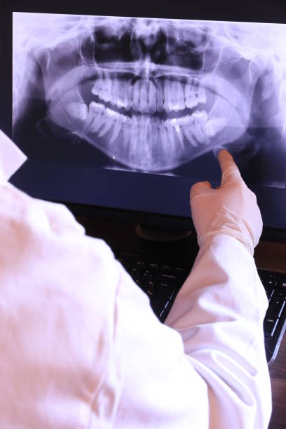 Best Mobile Emergency Dentist in West Hollywood, CA